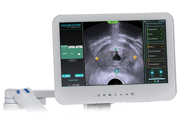 A medical device monitor displaying ultrasound imaging software used during an Aquablation therapy procedure.