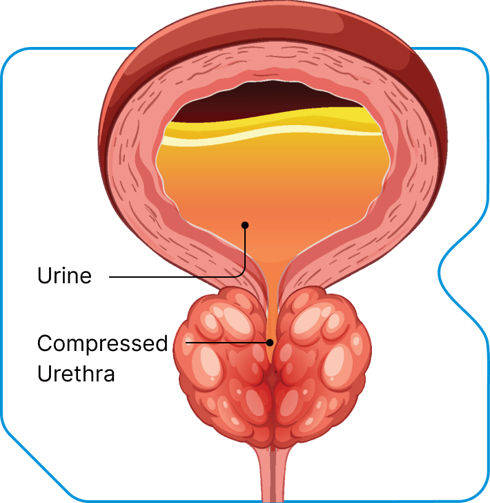 Illustration bladder and prostate